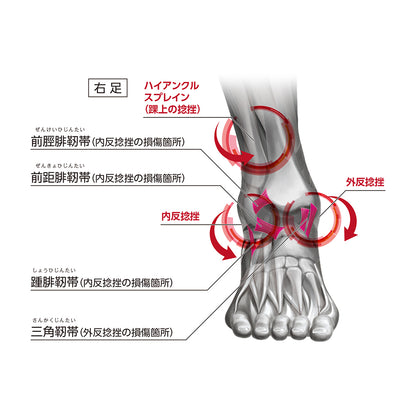 Adjustable Ankle Stabilizer